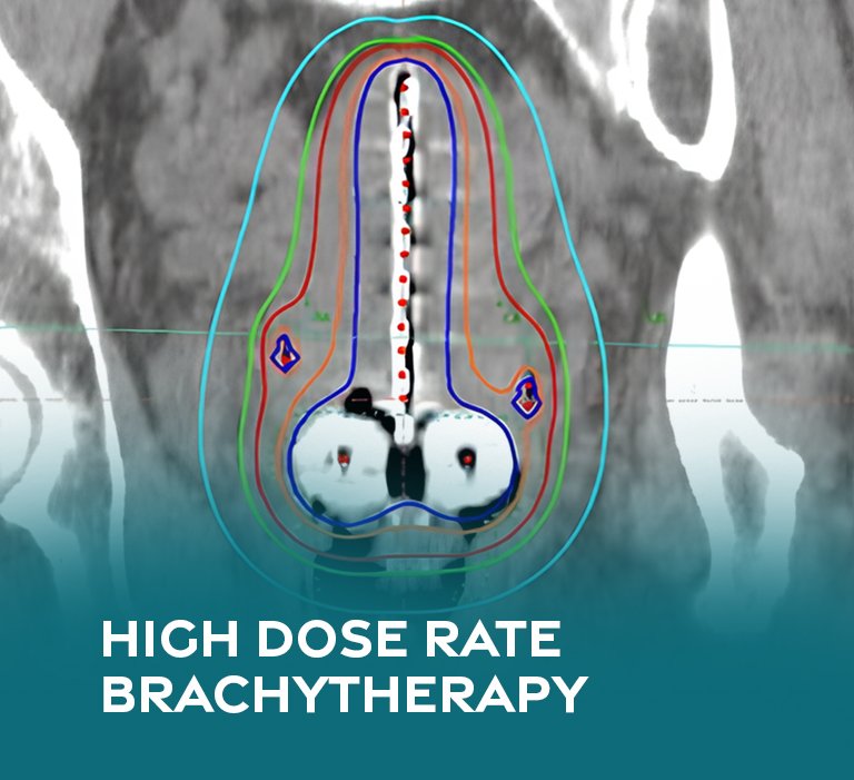 https://villageoncology.health/wp-content/uploads/2025/11/HIGH-DOSE-RATE.jpg
